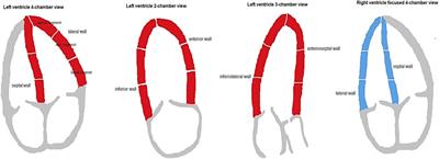 Systolic myocardial function measured by echocardiographic speckle-tracking and peak oxygen consumption in pediatric childhood cancer survivors—a PACCS study